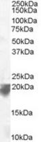 VPS29 Retromer Complex Component antibody, TA302920, Origene, Western Blot image 