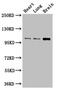 RNA Binding Motif Protein 10 antibody, CSB-PA019400LA01HU, Cusabio, Western Blot image 