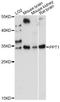 Palmitoyl-protein thioesterase 1 antibody, LS-C749749, Lifespan Biosciences, Western Blot image 