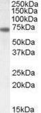 Netrin 1 antibody, GTX88460, GeneTex, Western Blot image 