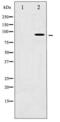 Aryl Hydrocarbon Receptor antibody, LS-C416654, Lifespan Biosciences, Western Blot image 