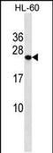 Phosphatidylcholine Transfer Protein antibody, PA5-48782, Invitrogen Antibodies, Western Blot image 