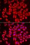 Solute Carrier Family 20 Member 2 antibody, orb247601, Biorbyt, Immunofluorescence image 