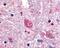 G Protein-Coupled Receptor 88 antibody, 48-289, ProSci, Enzyme Linked Immunosorbent Assay image 