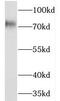 NEDD1 Gamma-Tubulin Ring Complex Targeting Factor antibody, FNab05644, FineTest, Western Blot image 