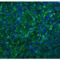 C-X-C Motif Chemokine Receptor 6 antibody, LS-B2518, Lifespan Biosciences, Immunofluorescence image 