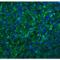 C-X-C Motif Chemokine Receptor 6 antibody, LS-B2518, Lifespan Biosciences, Immunofluorescence image 