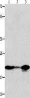 NME/NM23 Nucleoside Diphosphate Kinase 1 antibody, CSB-PA079049, Cusabio, Western Blot image 