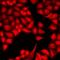 Dual Specificity Tyrosine Phosphorylation Regulated Kinase 2 antibody, LS-C667985, Lifespan Biosciences, Immunofluorescence image 