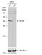 Electron Transfer Flavoprotein Subunit Alpha antibody, NBP2-16382, Novus Biologicals, Western Blot image 