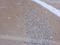 CD226 Molecule antibody, GTX118131, GeneTex, Immunohistochemistry paraffin image 