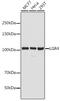 Leucine Rich Repeat Containing G Protein-Coupled Receptor 4 antibody, GTX64474, GeneTex, Western Blot image 