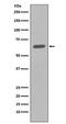 Histone Deacetylase 2 antibody, M00325-1, Boster Biological Technology, Western Blot image 