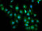 Zinc Finger MIZ-Type Containing 1 antibody, LS-C681736, Lifespan Biosciences, Immunofluorescence image 