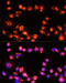 Mixed Lineage Kinase Domain Like Pseudokinase antibody, 14-026, ProSci, Immunofluorescence image 