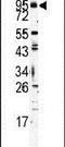 Toll Like Receptor 6 antibody, PA5-11603, Invitrogen Antibodies, Western Blot image 