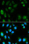 Mitochondrial uncoupling protein 3 antibody, STJ26032, St John