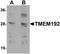 Transmembrane Protein 192 antibody, LS-C144343, Lifespan Biosciences, Western Blot image 