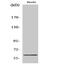 Cysteine And Serine Rich Nuclear Protein 2 antibody, A16562, Boster Biological Technology, Western Blot image 