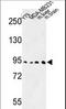 Dipeptidyl Peptidase Like 10 antibody, LS-C167517, Lifespan Biosciences, Western Blot image 