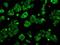 Aconitase 2 antibody, NBP2-02241, Novus Biologicals, Immunocytochemistry image 