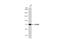 Sterile Alpha And TIR Motif Containing 1 antibody, GTX636102, GeneTex, Western Blot image 