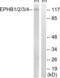 Ephrin B1 antibody, LS-C118304, Lifespan Biosciences, Western Blot image 