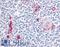 CD49D antibody, LS-A9388, Lifespan Biosciences, Immunohistochemistry frozen image 