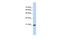 Transcription Elongation Factor A Like 8 antibody, PA5-43549, Invitrogen Antibodies, Western Blot image 