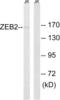 Zinc Finger E-Box Binding Homeobox 2 antibody, LS-B5497, Lifespan Biosciences, Western Blot image 