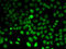 Acetylserotonin O-Methyltransferase antibody, A03899, Boster Biological Technology, Western Blot image 