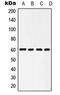 Heat Shock Protein Family D (Hsp60) Member 1 antibody, LS-B16075, Lifespan Biosciences, Western Blot image 