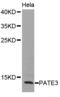 Prostate And Testis Expressed 3 antibody, STJ24903, St John