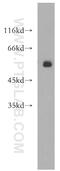 DEAD-Box Helicase 19B antibody, 18285-1-AP, Proteintech Group, Western Blot image 