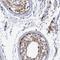 Ankyrin repeat and protein kinase domain-containing protein 1 antibody, NBP1-86849, Novus Biologicals, Immunohistochemistry frozen image 