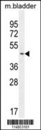 Prolyl-TRNA Synthetase 2, Mitochondrial antibody, MBS9210250, MyBioSource, Western Blot image 