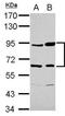 Complement Factor B antibody, NBP2-15953, Novus Biologicals, Western Blot image 