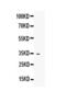 Insulin Like Growth Factor Binding Protein 1 antibody, PA5-79447, Invitrogen Antibodies, Western Blot image 