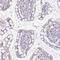 Adenylate Kinase 1 antibody, HPA006456, Atlas Antibodies, Immunohistochemistry frozen image 