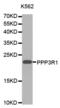 Protein Phosphatase 3 Regulatory Subunit B, Alpha antibody, abx000913, Abbexa, Western Blot image 