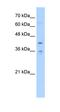 Transmembrane Protein 104 antibody, orb325334, Biorbyt, Western Blot image 