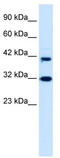 Zinc finger protein neuro-d4 antibody, TA335741, Origene, Western Blot image 