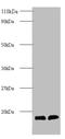 Cystatin B antibody, A52620-100, Epigentek, Western Blot image 