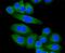 Low Density Lipoprotein Receptor antibody, NBP2-67414, Novus Biologicals, Immunocytochemistry image 