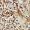 RODH antibody, FNab04027, FineTest, Immunohistochemistry paraffin image 