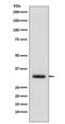 Enkurin, TRPC Channel Interacting Protein antibody, M16600, Boster Biological Technology, Western Blot image 