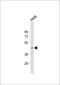 Actin Like 8 antibody, 59-547, ProSci, Western Blot image 