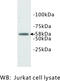 DNA Nucleotidylexotransferase antibody, MBS355061, MyBioSource, Western Blot image 