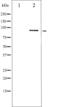 Signal Transducer And Activator Of Transcription 5B antibody, GTX52330, GeneTex, Western Blot image 