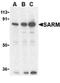 Sterile Alpha And TIR Motif Containing 1 antibody, ADI-CSA-509-E, Enzo Life Sciences, Western Blot image 